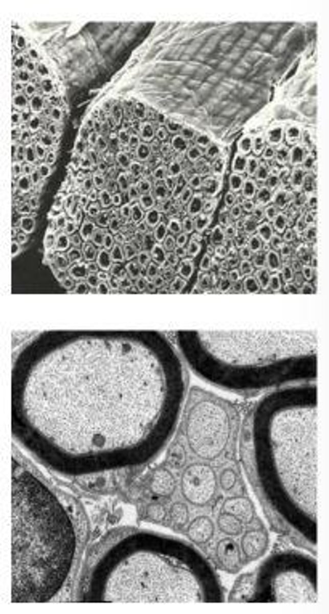 <p>A fatty layer that insulates nerve fibers and improves conduction speeds.</p>