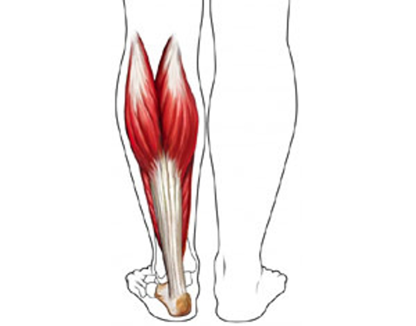 <p>injury in which muscle or tendon has been stretched too far or torn</p>
