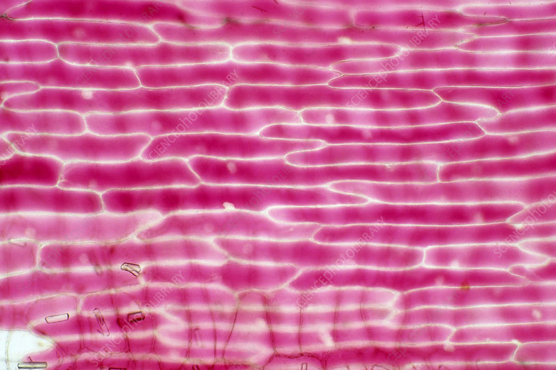 <p>How does osmosis occur in the onion cells in the hypotonic solution (distilled water)?</p><p></p><p></p>