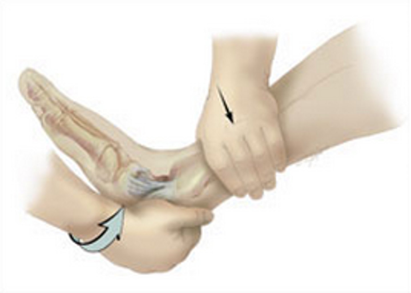 <p>Calcaneofibular or deltoid ligament instability</p>