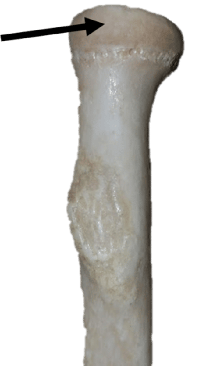 <p>for the radial notch of the ulna</p>