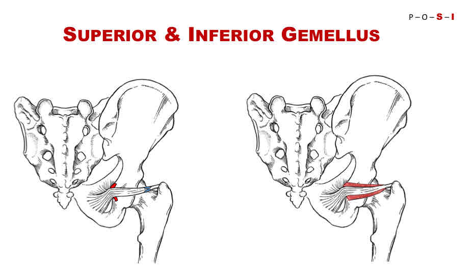 <p>Insertion of Superior Gemellus</p>