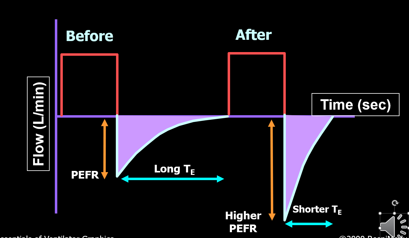<p>What is going on in the flow time waveform?</p>