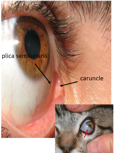 <ul><li><p>Nodular tissue situated between plica semilunaris and the medial canthus</p></li><li><p>Likened to non-keratinized skin</p><ul><li><p>contains pilosebaceous unit with cilia, accessory lacrimal gland tissue, and numerous sebaceous glands</p></li></ul></li></ul><p></p>