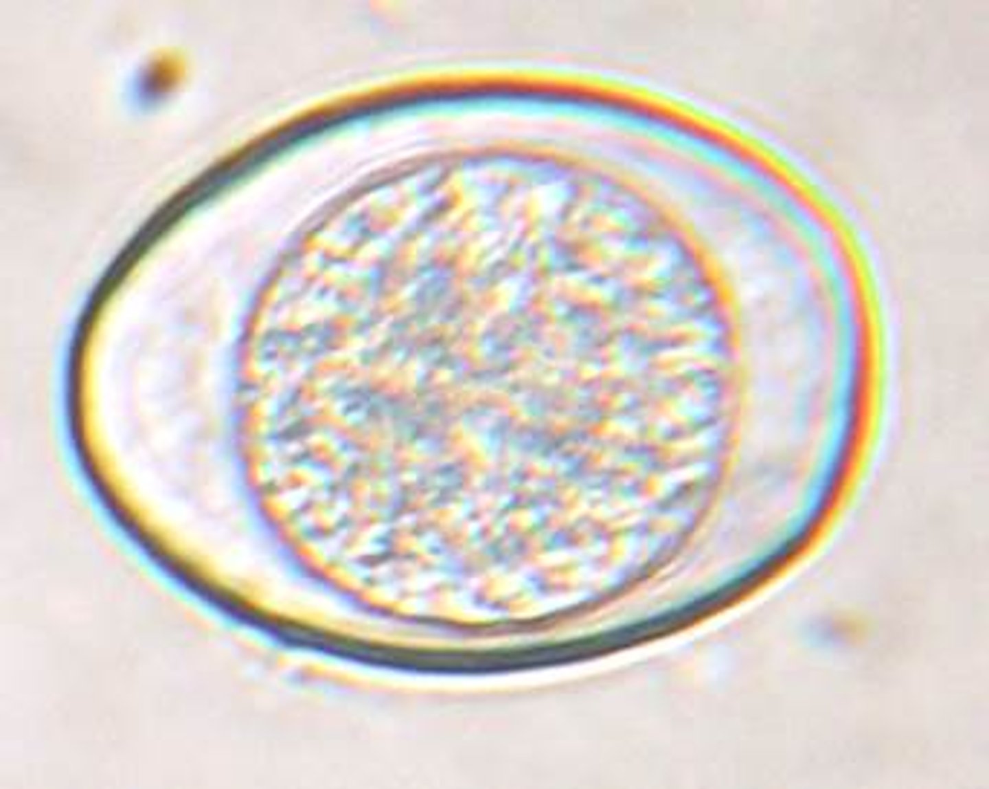 <p>This structure was found on the fecal flotation of a DSH (cat). It measures approximately 30x 40 um. What is it?</p>