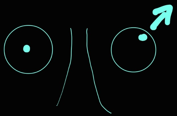 <p>cranial nerve III</p>