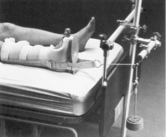 <p>manual (aka skin) traction</p>