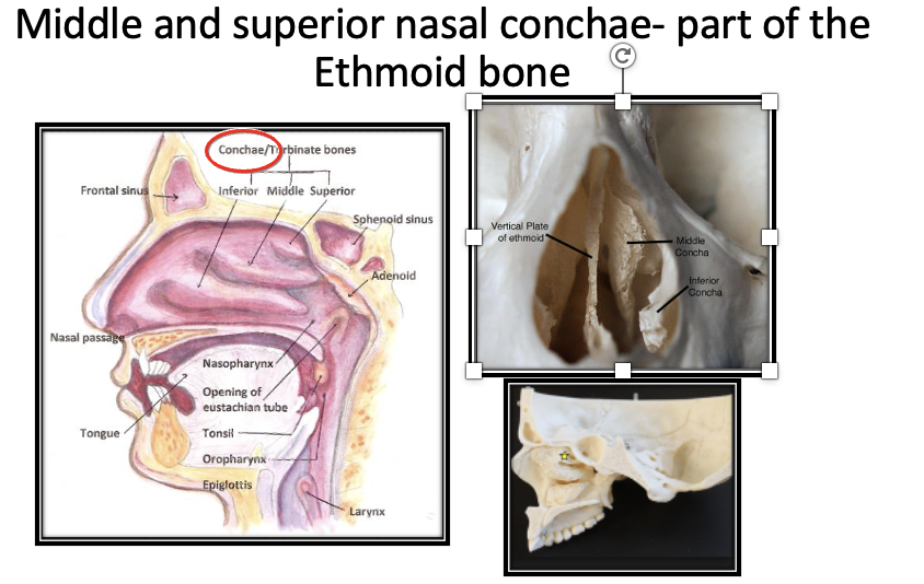 <p><span>perpendicular plate and superior nasal concha </span><span style="font-family: Calibri, sans-serif"> </span></p>