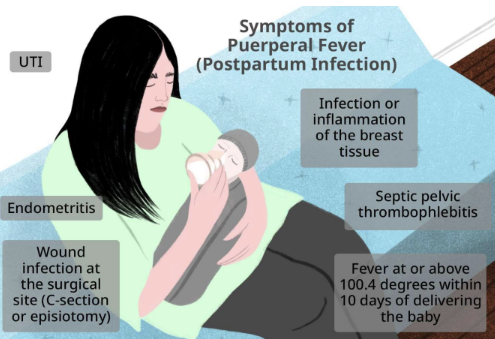 <p>Infection of the reproductive tract following childbirth, leading to septicemia.</p><p>caused by <em>Streptococcus pyogenes.</em></p><p>transmitted through c<span><span>ontact with contaminated hands of healthcare workers during delivery.</span></span></p>