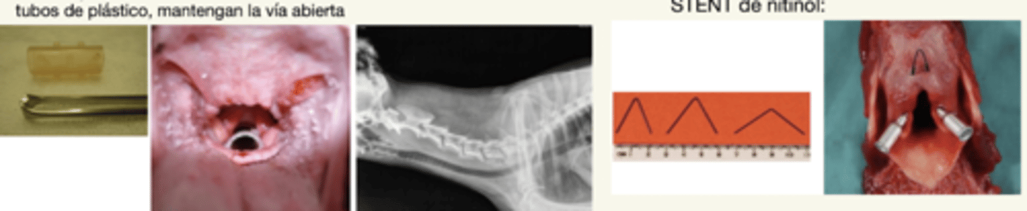 <p>un tubo de plástico o nitinol, que mantiene la vía respiratoria abierte.</p><p>usado para colapso laríngeo o traqueal</p>