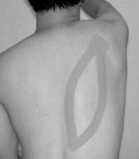 <p>the theory behind elastic taping for SA “impingement” is increasing __________ tilt and increasing activity of the ____________ muscle </p>