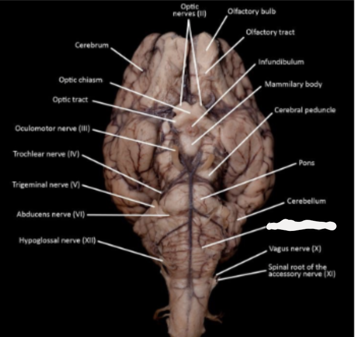 <p>What part of the brain is marked out? </p>