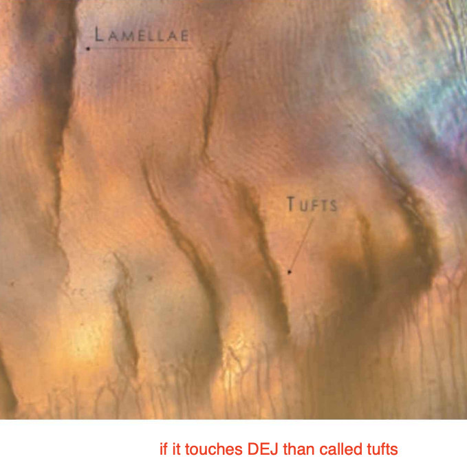<ul><li><p><strong>Brush-like structures</strong> extending outward from the <strong>dentin-enamel junction (DEJ)</strong></p></li><li><p><strong>Hypomineralized regions</strong> containing increased residual enamel matrix proteins, likely due to changes in the direction of adjacent enamel rods originating from different areas of the <strong>scalloped dentin-enamel junction</strong></p></li><li><p>May <strong>assist in the resilience of enamel</strong></p></li></ul><p></p>