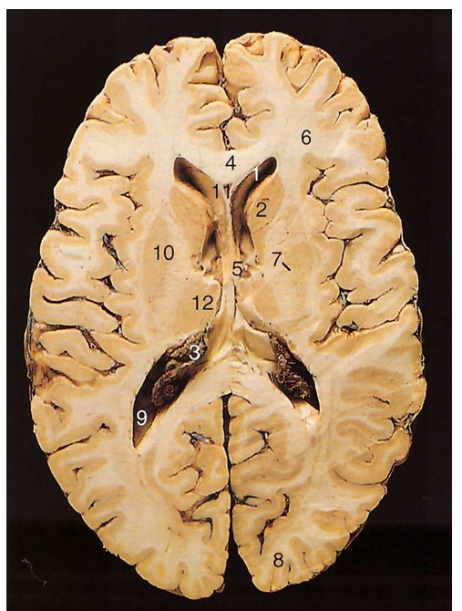 <p>name 1 3 9 11 </p>