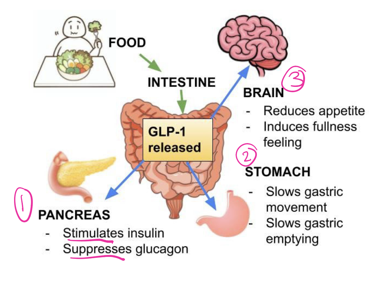 <p>for diabetics T2: GLP-1 agonists stimulate pancreas to release insulin and suppress release of glucagon—→ hormones that help control blood sugar lvls.</p><ul><li><p>their body cells are resistant to effects of insulin, does not produce enough or both</p></li></ul><p>-also act in the brain to reduce hunger and act on the stomach to delay emptying, so you feel full for a longer time. These effects can lead to weight loss, which can be an important part of managing diabetes. GLP-1 agonists have been used to treat type 2 diabetes for about two decades.</p><ul><li><p>FDA has approved several GLP-1 agonists for weight loss in people with obesity who do not have diabetes. When used for overweight or obesity, the drugs are typically prescribed in higher doses than when prescribed for diabetes.</p></li></ul><p></p>