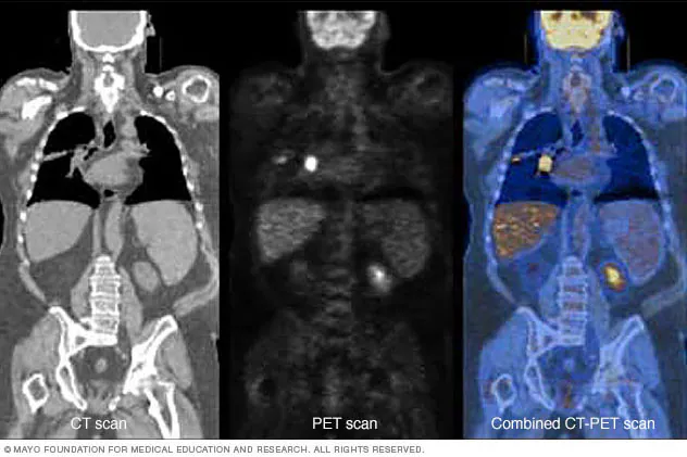 <p>PET - used to look at the brain and detect cancer</p>