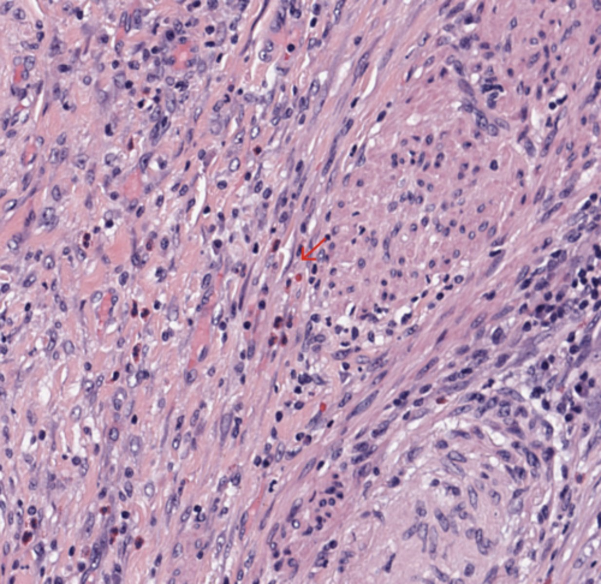 <p>Colon</p>