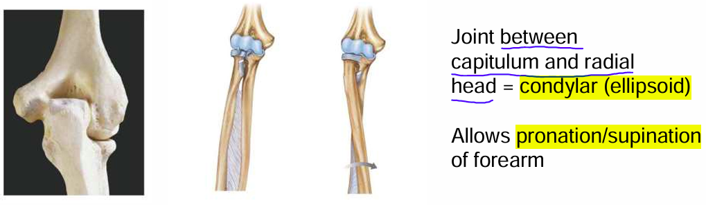 <p>Condylar (ellipsoid)</p><p><span>It allows pronation/supination.</span></p>
