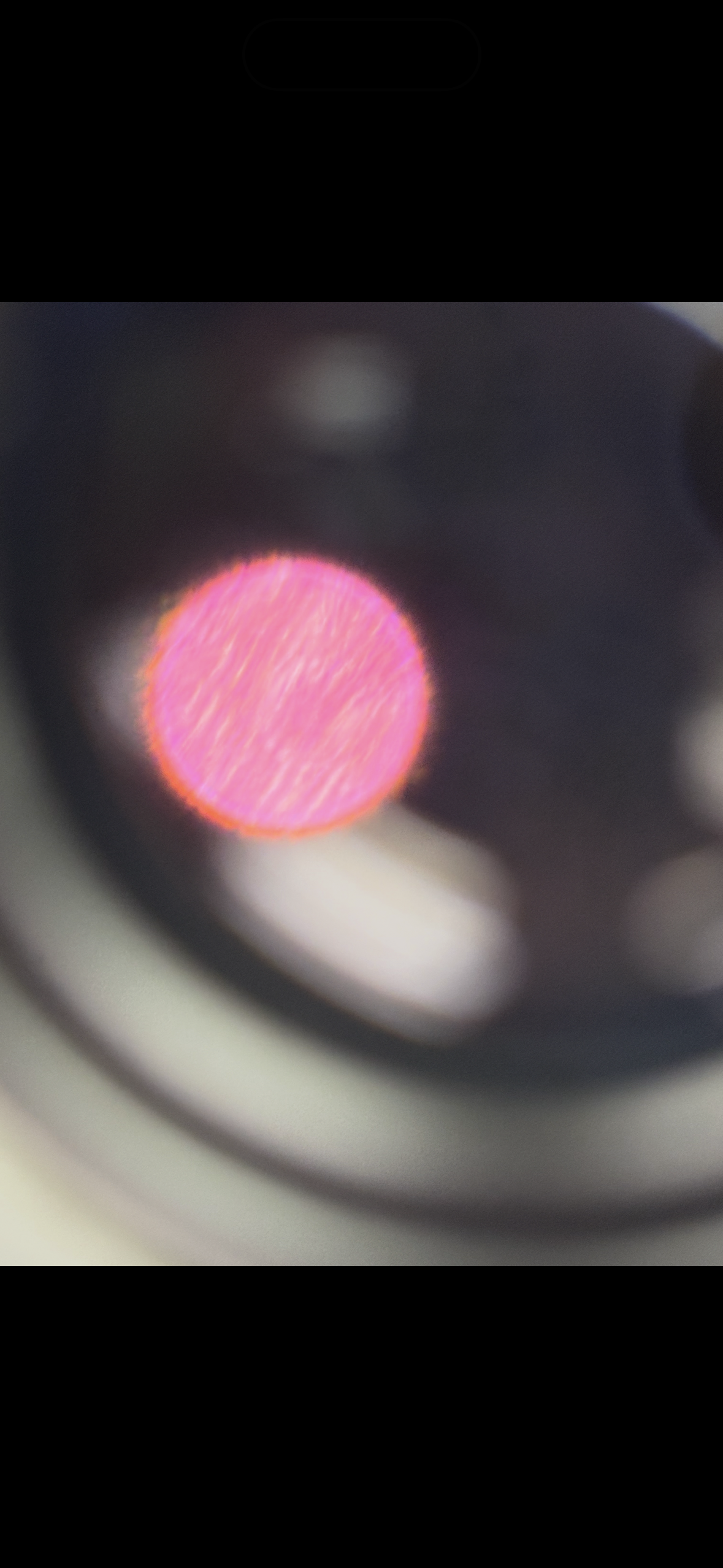 <p>Body location: skeletal muscles</p>