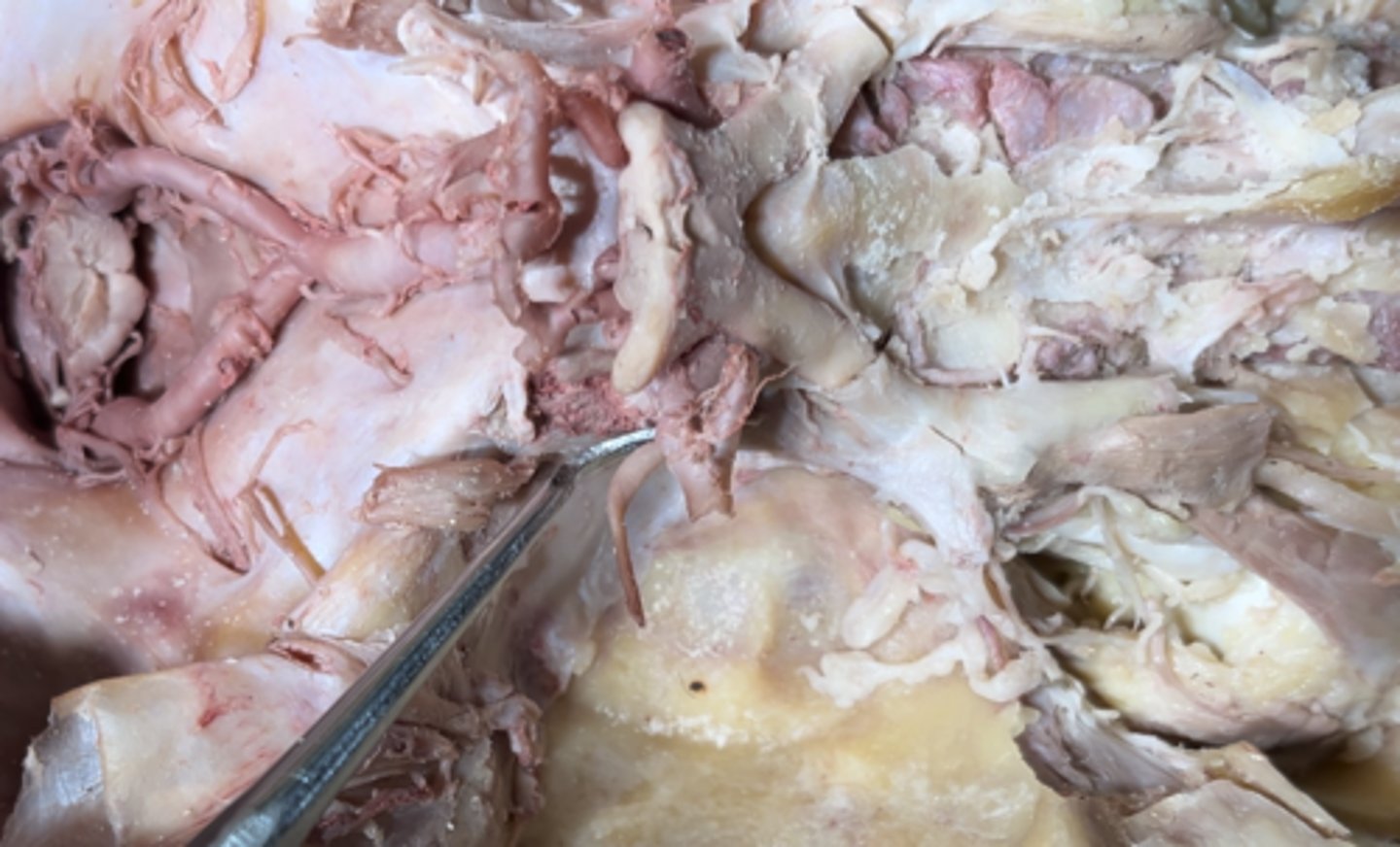 <p>The nerve pointed at is the</p>