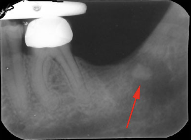 <p>what does the red arrow represent</p>