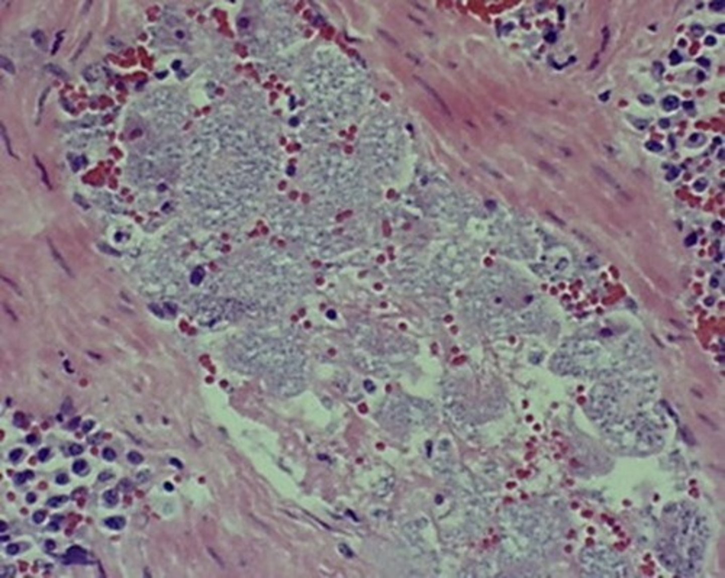 <p>ID the following parasites occluding blood vessel (cat)</p>