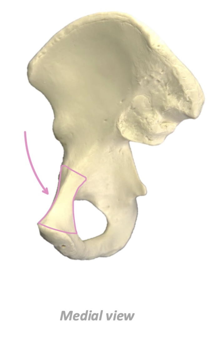 term image