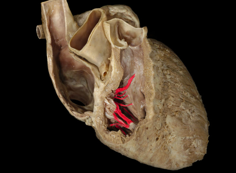 term image