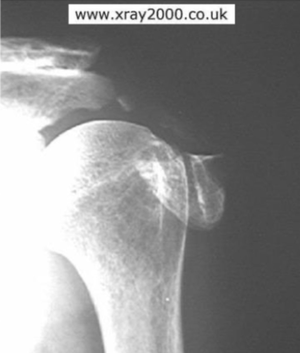 <p>What is the issue?</p>