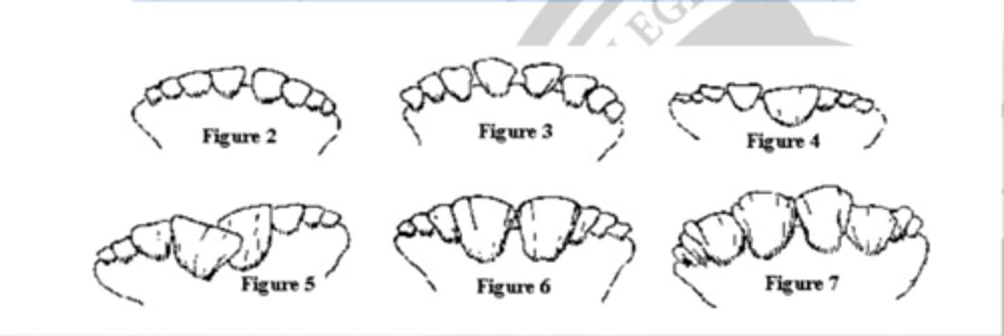 <p>when permanent incisors erupt....</p>