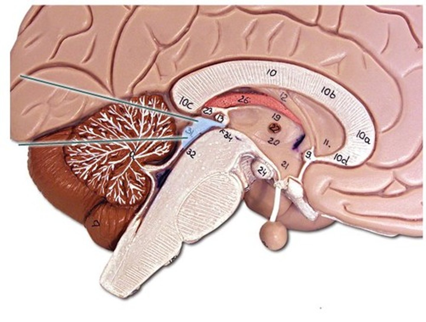 <p>bilateral structure (4 bumps) on the top of the midbrain, process/ orients visual (superior) and auditory (inferior) stimuli for reflexive action</p><p>-Put together they are called tectum</p>