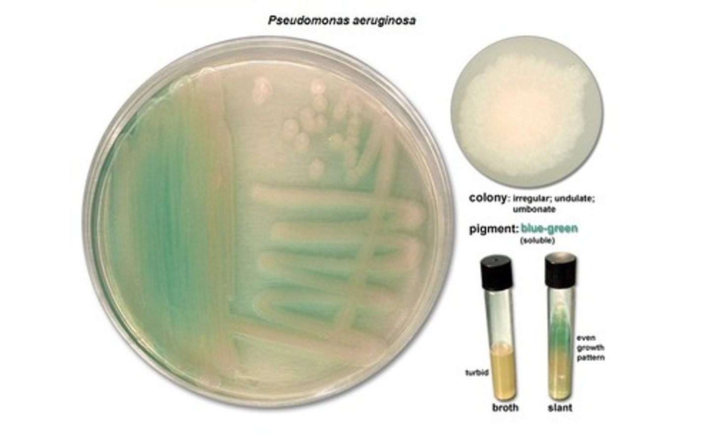 <p>1. Gram-negative (aerobic)</p><p>2. Pyocyanin produces a blue-green pus</p><p>4. Pseudomonas dermatitis - Self-limiting rash acquired in swimming pools</p><p>5. Otitis externa - “Swimmer’s ear</p><p>6. cystic fibrosis or burn patients; immunocompromised individuals</p><p>7. Resistant to many antibiotics (CDC serious threat list)</p>