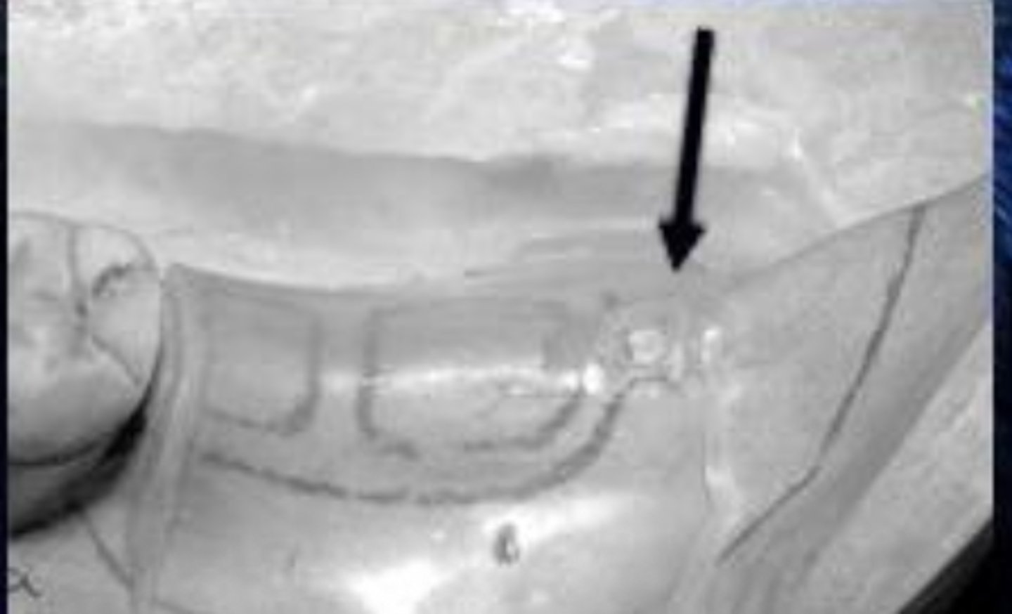 <p>What is the arrow pointing to?</p>