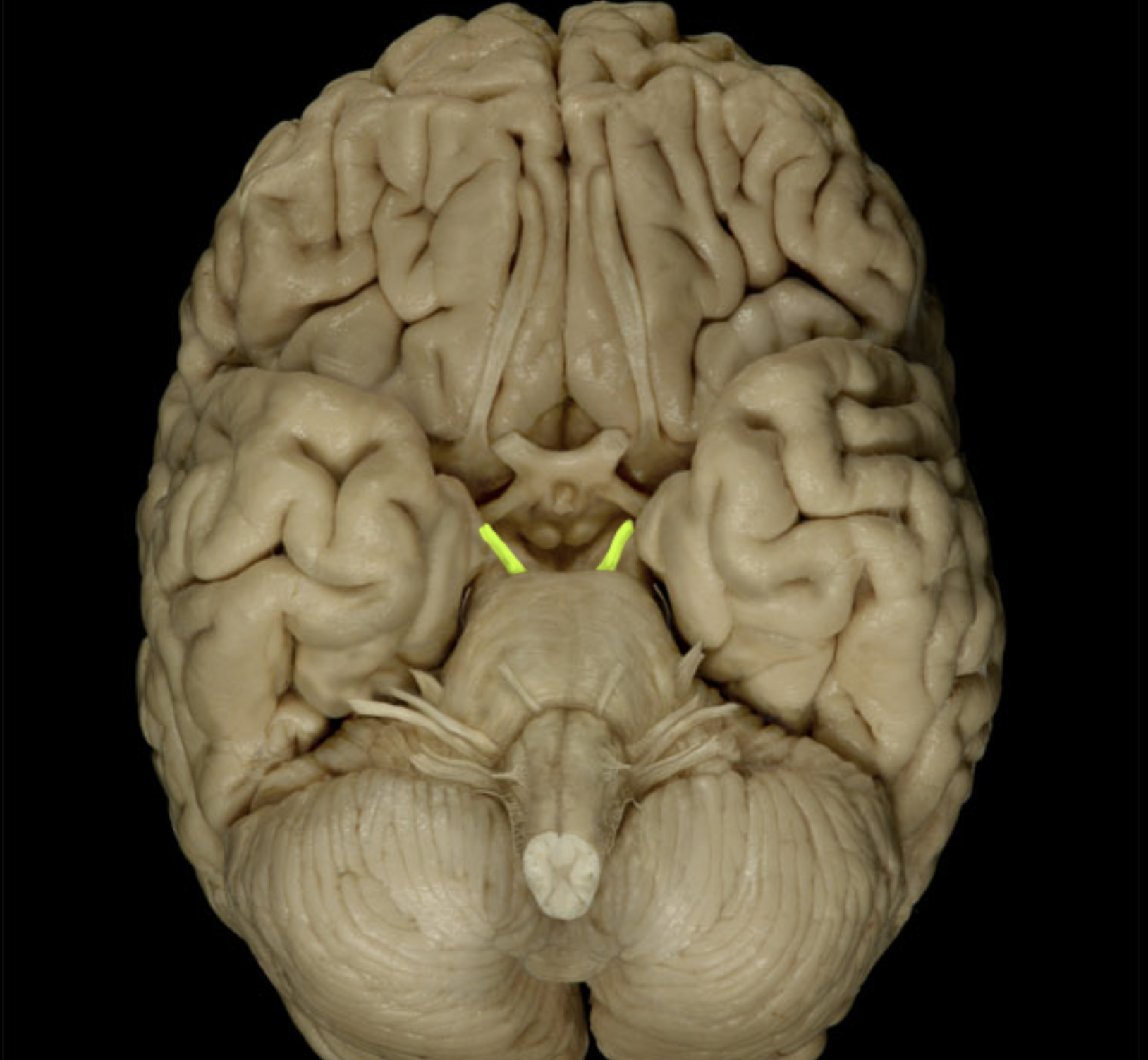 term image