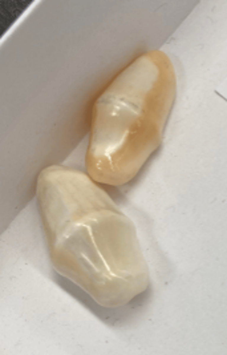 <p>false cowries</p>