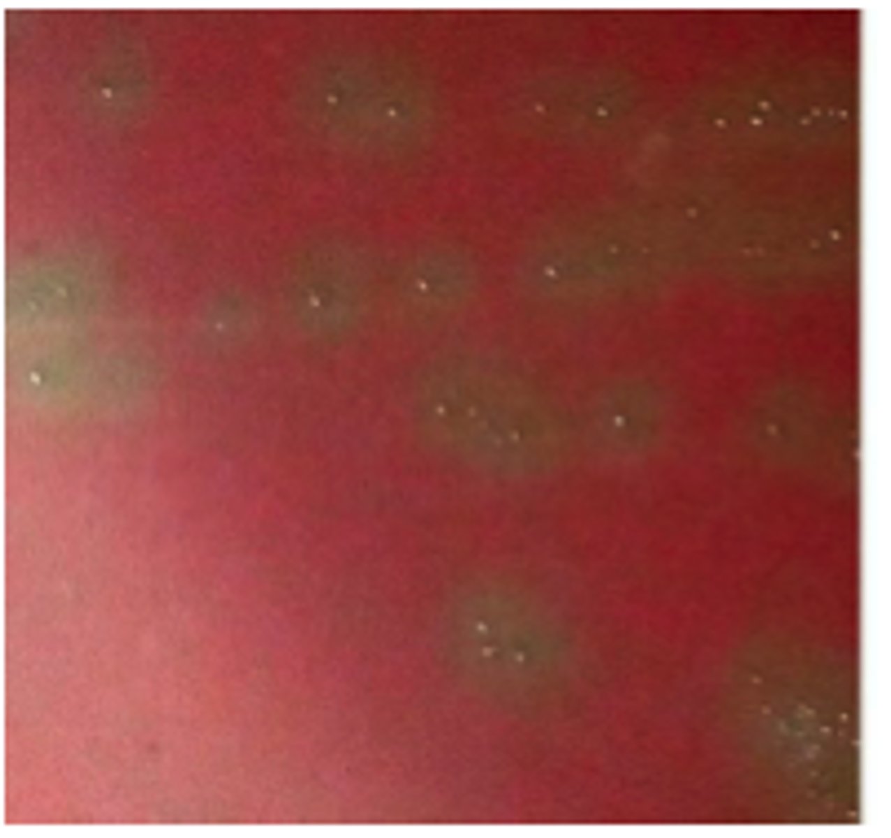 <p>The organism on the BA plate provided was isolated from a milk specimen of a Holstein</p><p>cow with acute mastitis. The organism did not grow on MAC.</p>