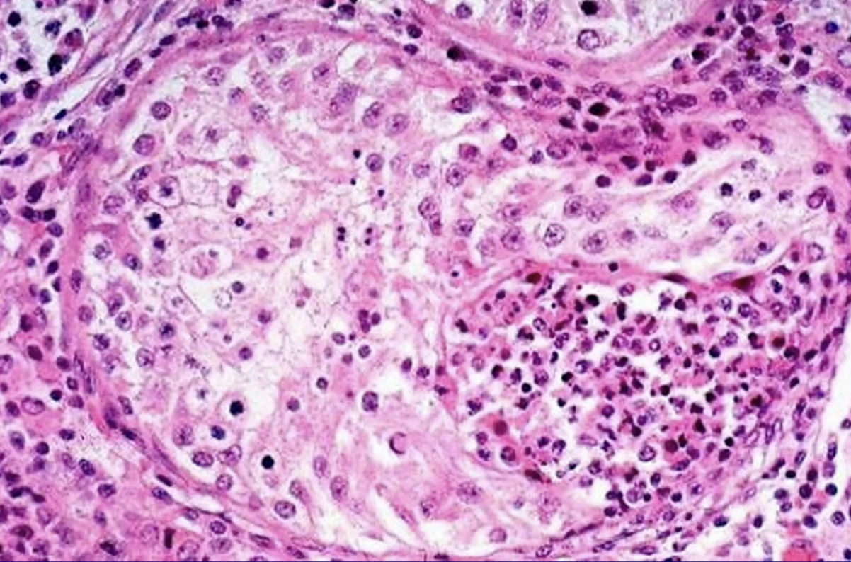 term image