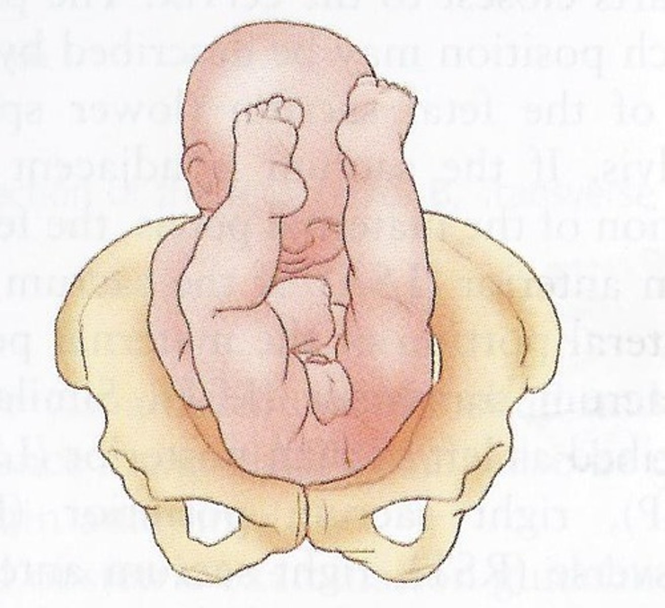 <p>fetal legs are extended across the abdomen toward the shoulders</p>