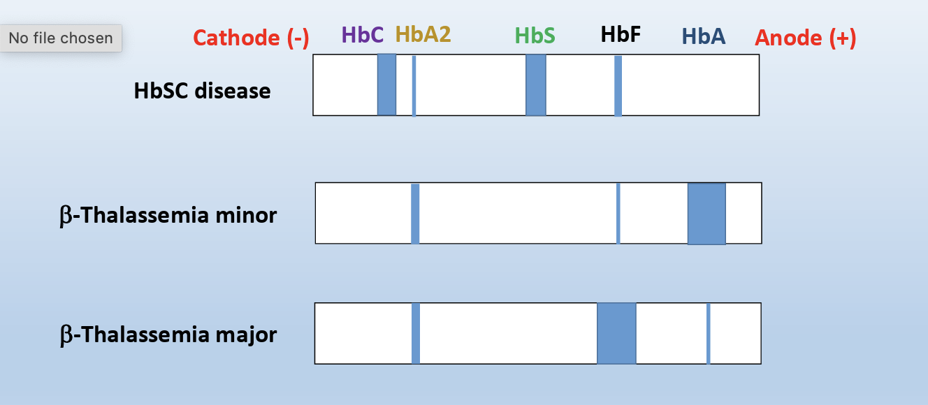 <p>B-major can be normal newborn</p>