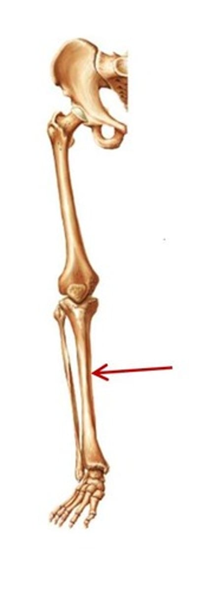 <p>ID bone</p>