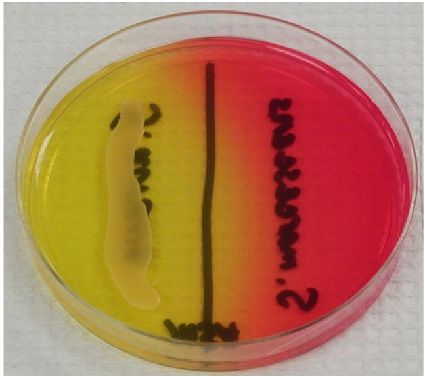 <p>Selects for halophilic species, primarily Staph-</p><p>Differentiates mannitol fermenters using phenol red (pH indicator) to change from red to yellow due to the fermentation’s acid byproduct</p>