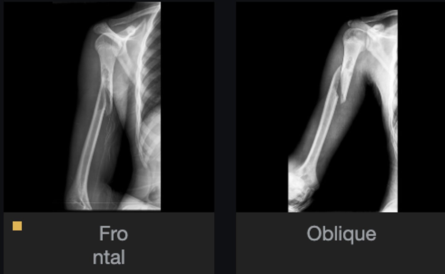 <p>Describe the lesion</p>