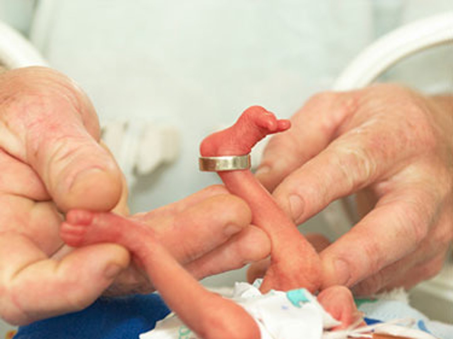 <p>low birth weight, ectopic pregnancy, placenta previa, placental abruption, preterm delivery, stillbirth, fetal growth restriction, sudden infant death syndrome (SIDS), birth defects, learning disabilities, and early puberty in girls.</p>
