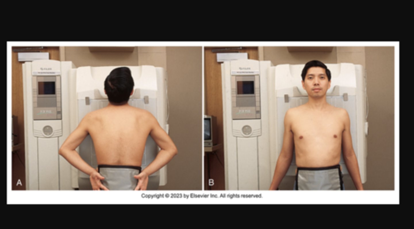 <p>upright; seated; supine; prone</p><p>Overall posture of the patient or general body position</p><p>also refers to the specific placement of the body or part in relation to the table or IR</p><p>A) Patient positioned for PA projection of the chest. The anterior aspect of the chest is closest to IRs. (B) Patient positioned for AP projection of the chest. The posterior aspect of the chest is closest to IRs.</p>