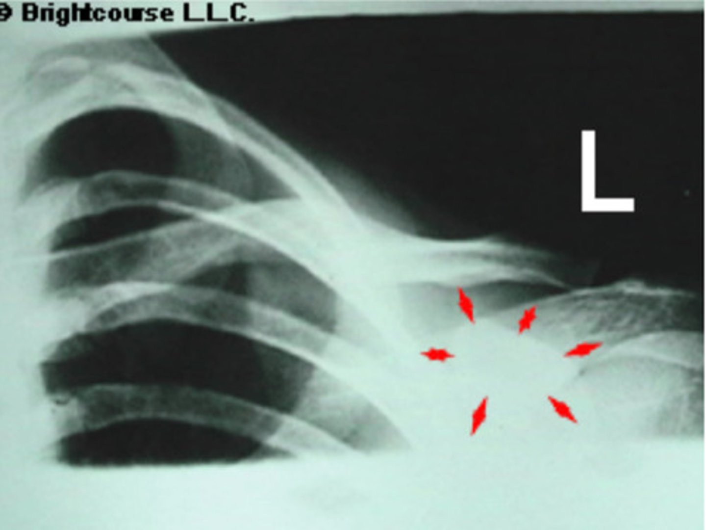 <p>What is being pointed out by the arrows in the image?</p>