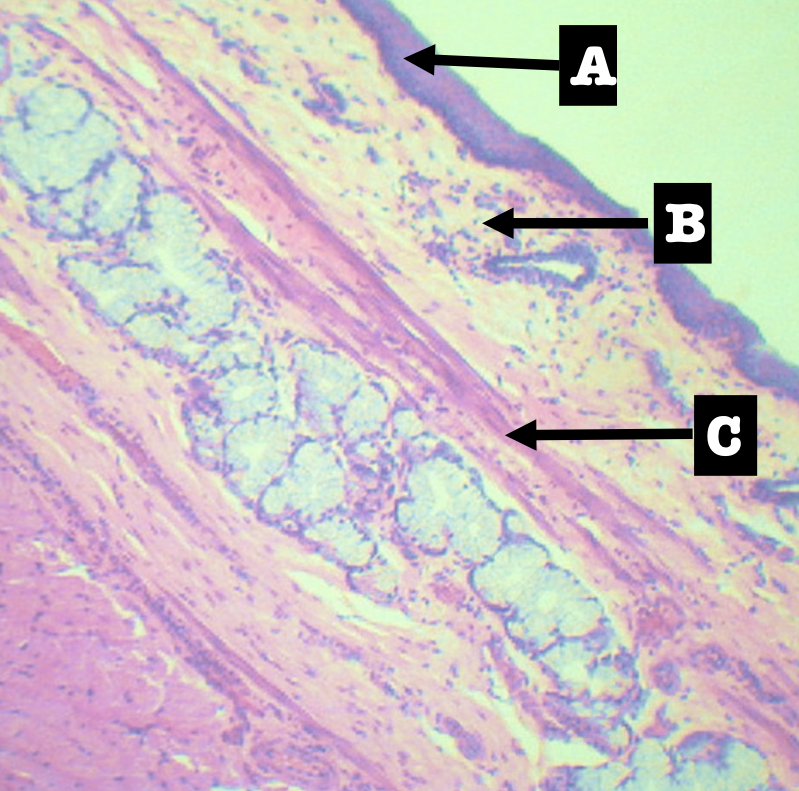 <p>Divides the lamina propria from the submucosa</p>