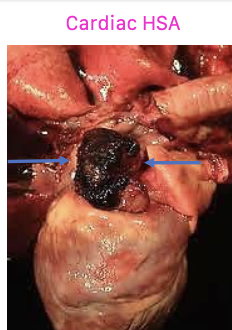 <p>second most common primary site:</p><p>-right atrium</p><p>-right auricle</p>
