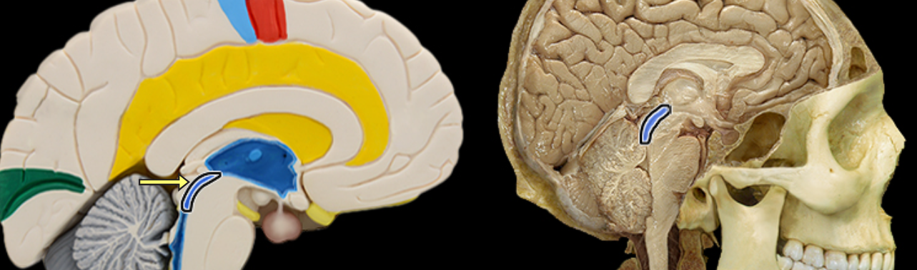 <p>Cerebral aqueduct</p>