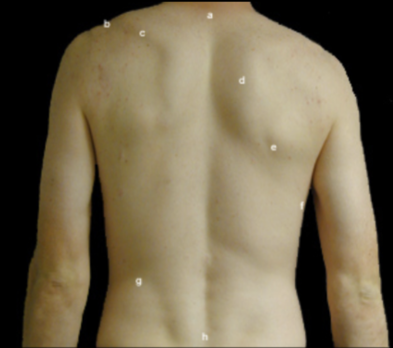 <p>Identify the Surface Anatomy of the Back</p>