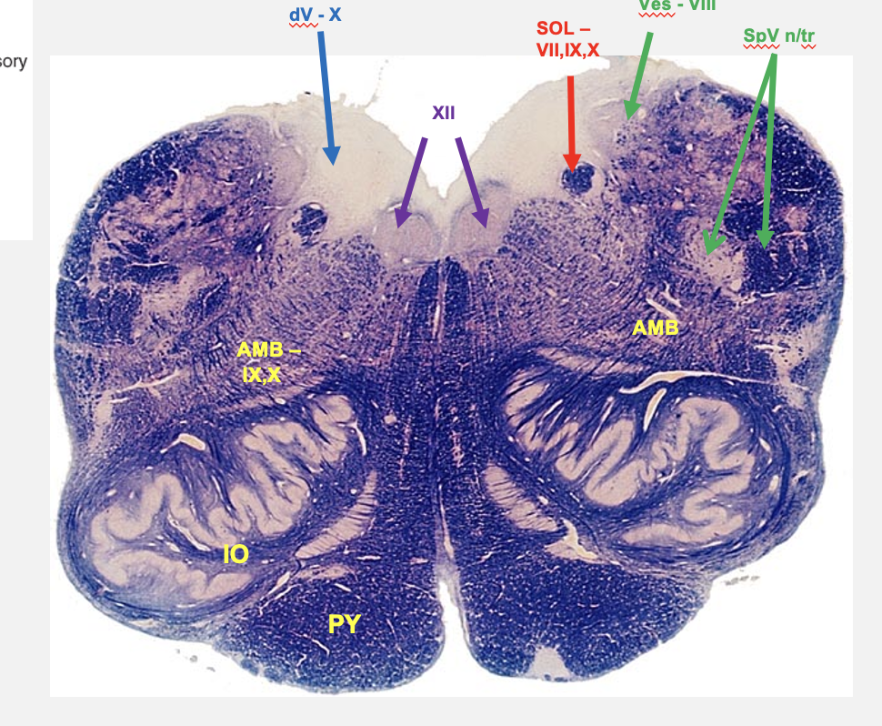 <p>rostral medulla cross section structures </p>